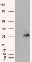 IL3RA Antibody