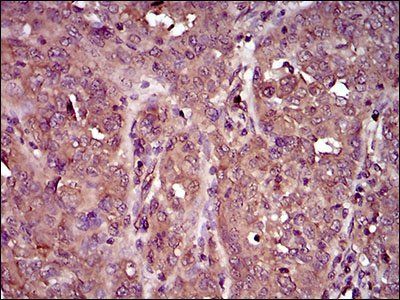 IL3RA Antibody