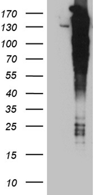 CSF2RB Antibody