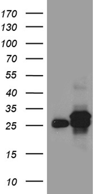 CSF2RB Antibody