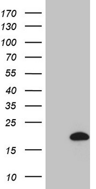 CSF2RB Antibody