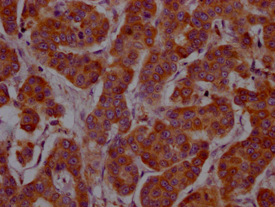 IL4 Recombinant Monoclonal Antibody
