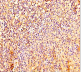 IL4I1 Antibody