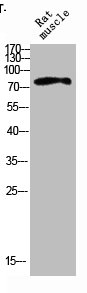 IL4R antibody