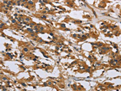 IL5RA Antibody