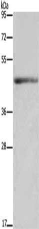 IL5RA antibody