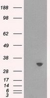 IL6 Antibody