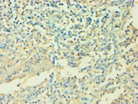 IL6 Antibody