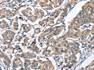HGF Antibody