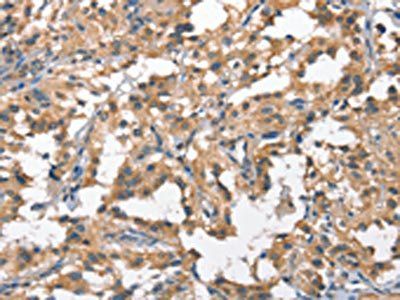 HGF Antibody