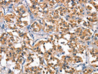 HGF Antibody