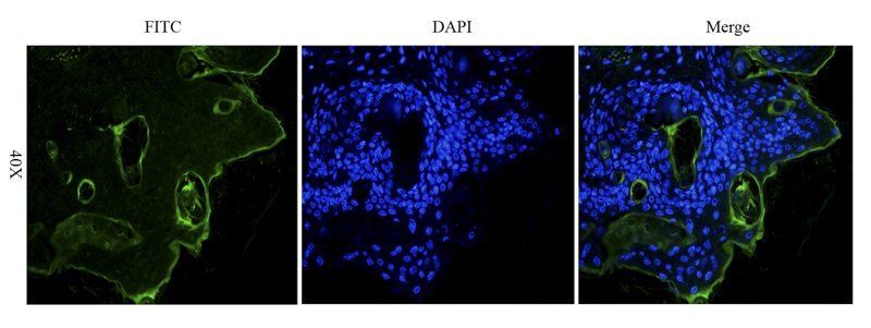 IL6 antibody (FITC)