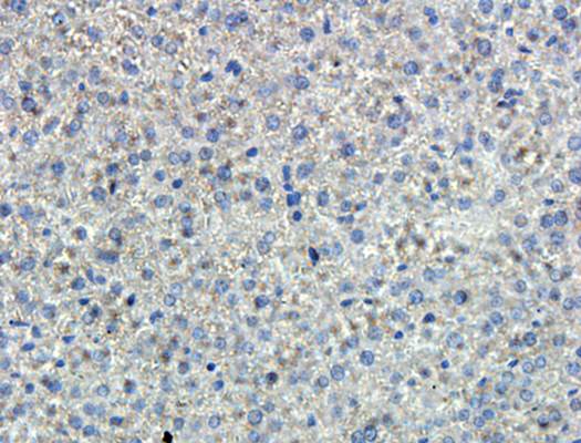 IL6 antibody