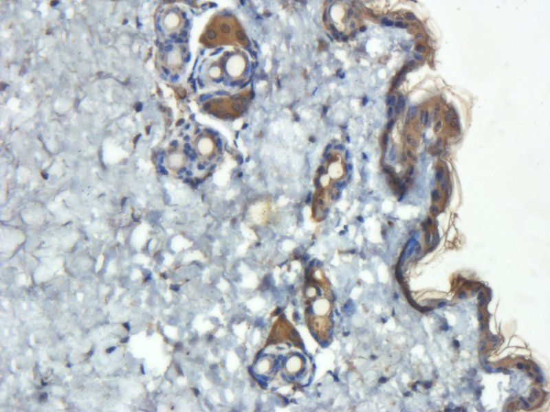 IL6 antibody