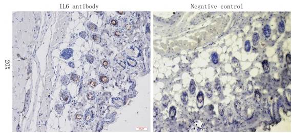 IL6 antibody