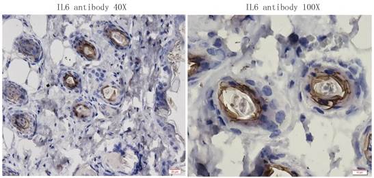 IL6 antibody