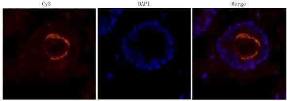 IL6 antibody