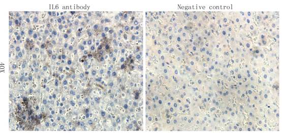 IL6 antibody