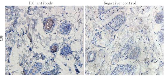 IL6 antibody