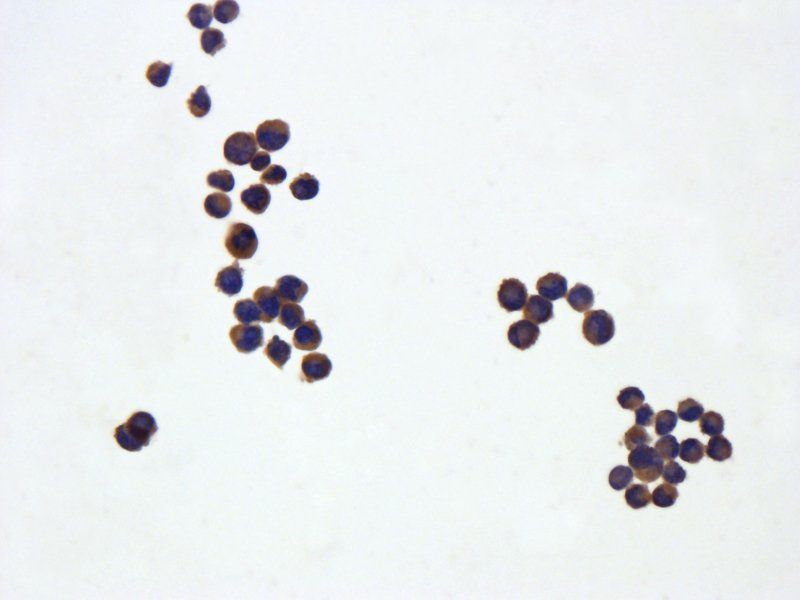 IL6 antibody