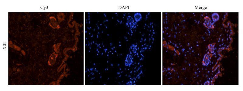 IL6 antibody