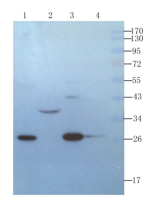 IL6 antibody