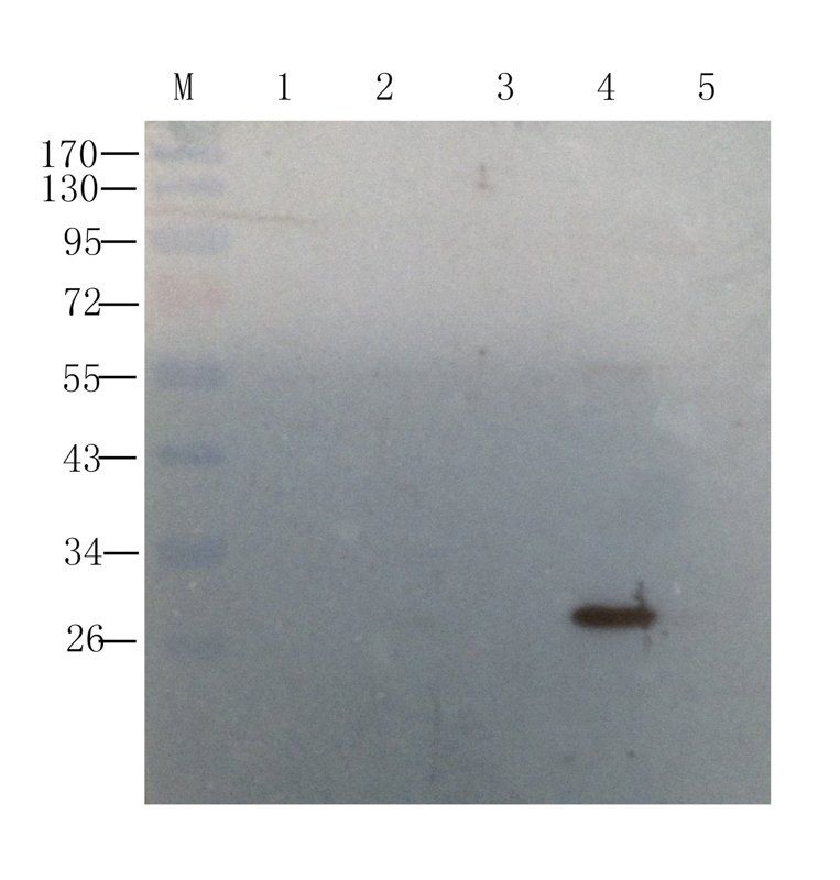 IL6 antibody