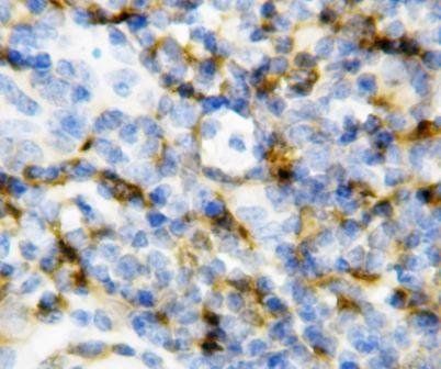 Interleukin-7 IL7 Rabbit Polyclonal Antibody