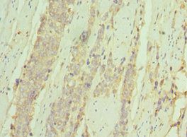 IL7R Antibody