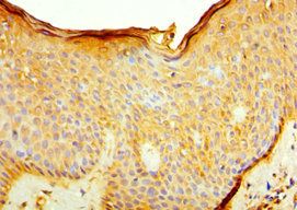 IL7R Antibody