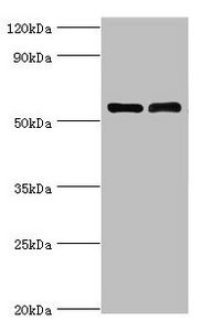 IL7R antibody