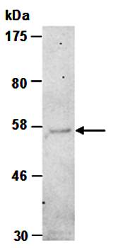 IL7Ra (M) Antibody, Rabbit Polyclonal