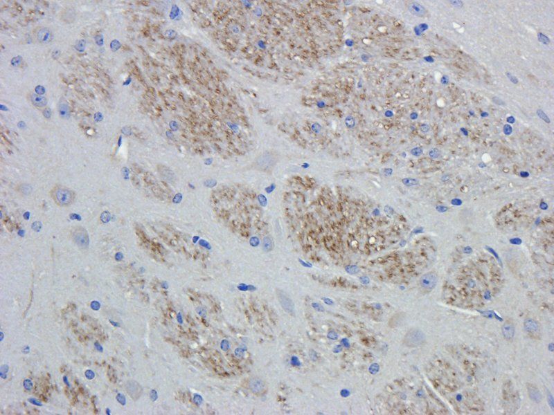 IL8 antibody