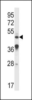 IL9R antibody
