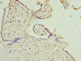 IL9R Antibody