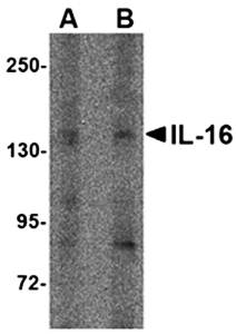 IL6 Antibody