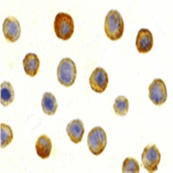 ILRAcP Antibody