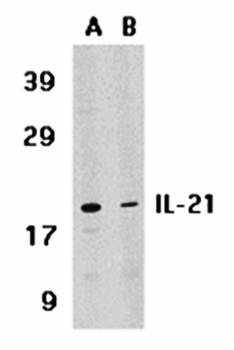 IL-21 Antibody