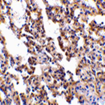 IL-21 Receptor Antibody