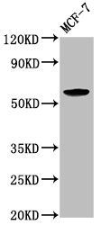 ILDR1 antibody