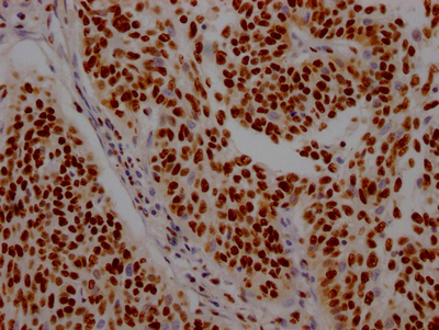 ILF3 Recombinant Monoclonal Antibody