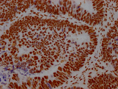 ILF3 Recombinant Monoclonal Antibody