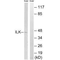 ILK (Ab-246) Antibody