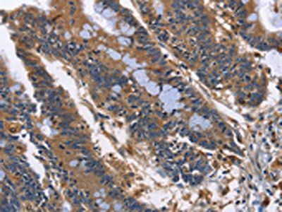 ILK Antibody