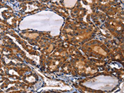 ILK Antibody