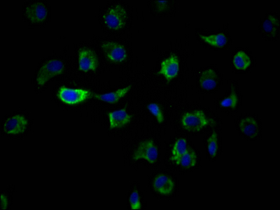 ILK Antibody