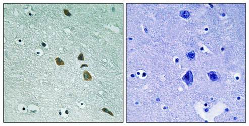 ILK (Ab-246) Antibody