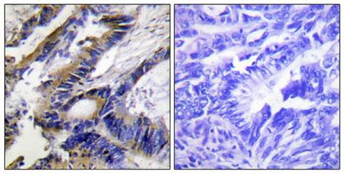 ILKAP Antibody