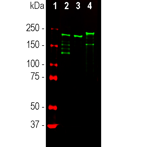 Neurofilament NF-H Antibody