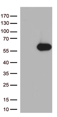 IGF2BP3 Antibody